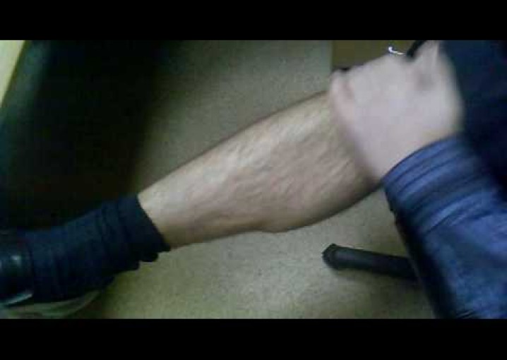 эпиляция мужской ноги